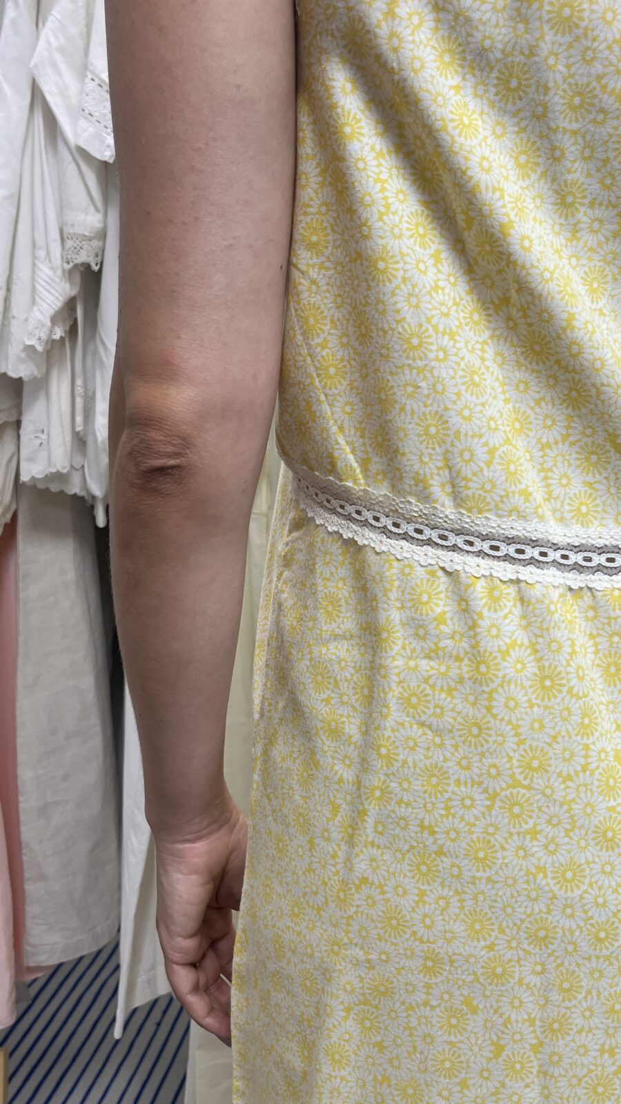 Camisón Vintage Amarillo con Estampado Floral y Encaje – Dama, Años 70 - Imagen 5